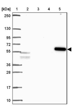 Activin RIB/ALK-4 Antibody, Novus Biologicals 0.1 mL | Buy Online | Novus Biologicals | Fisher Scientific