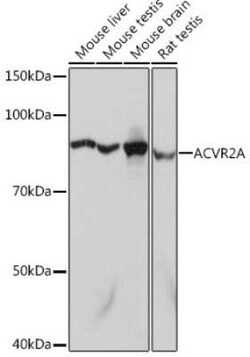 Activin RIIA Rabbit anti-Human, Mouse, Rat, Clone: 1K1J10, Novus Biologicals 20 &mu;g | Buy Online | Bio-Techne | Fisher Scientific