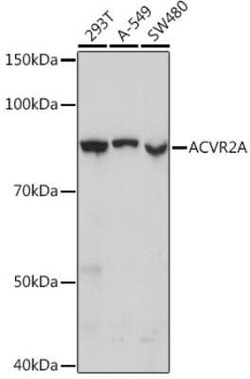 Activin RIIA Rabbit anti-Human, Mouse, Rat, Clone: 1K1J10, Novus Biologicals 20 &mu;g | Buy Online | Bio-Techne | Fisher Scientific