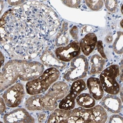 Acylglycerol Kinase Antibody, Novus Biologicals 25 &mu;L; Unlabeled:Antibodies,