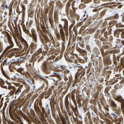 Acylglycerol Kinase Antibody, Novus Biologicals 25 &mu;L; Unlabeled:Antibodies,