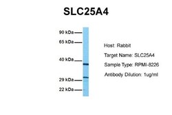 Adenine Nucleotide Translocase 1 Antibody, Novus Biologicals 0.05mg; Unlabeled:Antibodies,