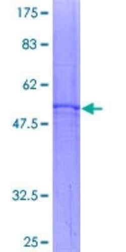 Novus Biologicals Recombinant Human Adenine Nucleotide Translocase 1 GST (N-Term) Protein 2 &mu;g | Buy Online | Novus Biologicals&trade; | Fisher Scientific