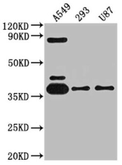 Adenosine A1R Antibody (10D12), Novus Biologicals 100 &mu;g | Buy Online | Novus Biologicals | Fisher Scientific
