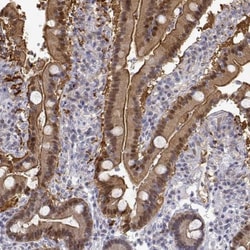 Adenosine Deaminase/ADA Antibody, Novus Biologicals:Antibodies:Primary