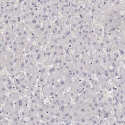 Adenosine Deaminase/ADA Antibody, Novus Biologicals:Antibodies:Primary