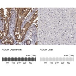 Adenosine Deaminase/ADA Antibody, Novus Biologicals:Antibodies:Primary