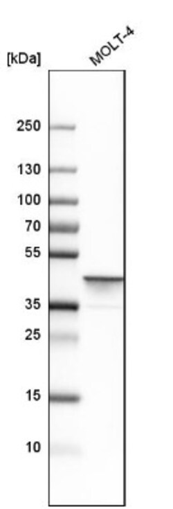 Adenosine Deaminase/ADA Antibody, Novus Biologicals:Antibodies:Primary