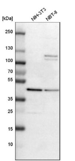 Adenosine Deaminase/ADA Antibody, Novus Biologicals:Antibodies:Primary