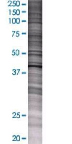 Novus Biologicals Adenosine Deaminase/ADA 293T Cell Transient Overexpression Lysate 0,1 mL | Buy Online | Novus Biologicals&trade; | Fisher Scientific