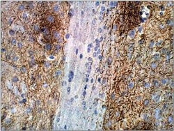 Adenylate Cyclase 2 Antibody, Novus Biologicals 100 &mu;g; Unconjugated:Antibodies,