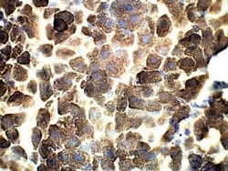 Adenylate Cyclase 3 Antibody, Novus Biologicals 100 &mu;g | Buy Online | Novus Biologicals | Fisher Scientific