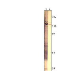 Adenylate Cyclase 3 Antibody, Novus Biologicals 100 &mu;g | Buy Online | Novus Biologicals | Fisher Scientific