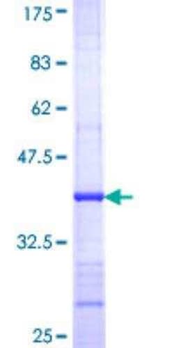 Novus Biologicals Recombinant Human Adenylate Cyclase 3 GST (N-Term) Protein 25 &mu;g | Buy Online | Novus Biologicals&trade; | Fisher Scientific