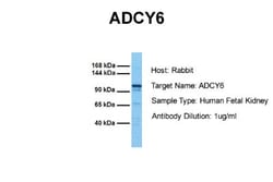 Adenylate Cyclase 6 Antibody, Novus Biologicals 0.05mg; Unlabeled:Antibodies,