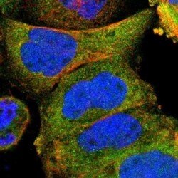 Adenylate Kinase 1 Antibody, Novus Biologicals 0.1mL; Unlabeled:Antibodies,
