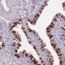 Adenylate Kinase 1 Antibody, Novus Biologicals 0.1mL; Unlabeled:Antibodies,