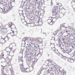 Adenylate Kinase 1 Antibody, Novus Biologicals 0.1mL; Unlabeled:Antibodies,