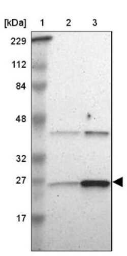 Adenylate Kinase 1 Antibody, Novus Biologicals 0.1mL; Unlabeled:Antibodies,