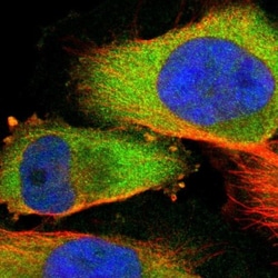 Adenylosuccinate Lyase Antibody, Novus Biologicals:Antibodies:Primary Antibodies