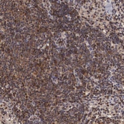 Adenylosuccinate Lyase Antibody, Novus Biologicals:Antibodies:Primary Antibodies