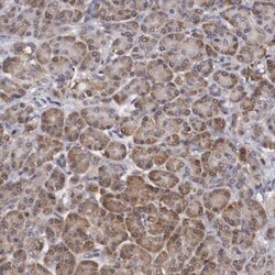 Adenylosuccinate Lyase Antibody, Novus Biologicals:Antibodies:Primary Antibodies