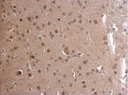 Adenylosuccinate Lyase Antibody, Novus Biologicals 0.1mL; Unlabeled:Antibodies,