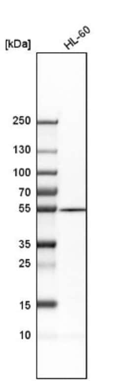 Adenylosuccinate Lyase Antibody, Novus Biologicals:Antibodies:Primary Antibodies