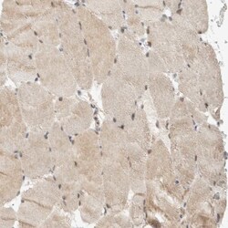 Adenylosuccinate Synthase Antibody, Novus Biologicals:Antibodies:Primary
