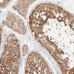 Adenylosuccinate Synthase Antibody, Novus Biologicals:Antibodies:Primary