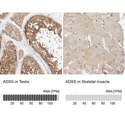 Adenylosuccinate Synthase Antibody, Novus Biologicals:Antibodies:Primary