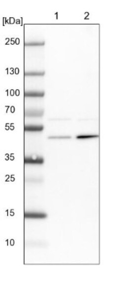 Adenylosuccinate Synthase Antibody, Novus Biologicals:Antibodies:Primary