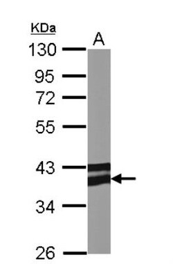 AdipoR1 Antibody, Novus Biologicals 0.1mL; Unlabeled:Antibodies, Polyclonal