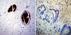 Adiponectin/Acrp30 Antibody (19F1), Novus Biologicals 0.1mg; Unlabeled:Antibodies,