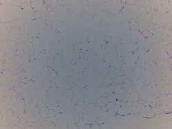 Novus Biologicals Adipose Tissue Slides (Adult Normal)- Paraffin 5 lames | Buy Online | Novus Biologicals&trade; | Fisher Scientific