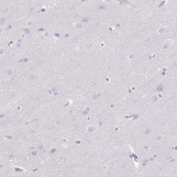 Adrenomedullin R/ADMR/GPR182 Antibody, Novus Biologicals 0.1mL; Unlabeled:Antibodies,