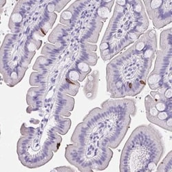 Advillin Antibody, Novus Biologicals:Antibodies:Primary Antibodies
