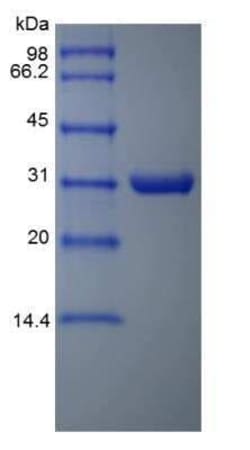 Novus Biologicals Recombinant Aeromonas Aminopeptidase Protein 500 &mu;g | Buy Online | Novus Biologicals&trade; | Fisher Scientific