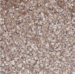 AgRP/ART Antibody, Novus Biologicals:Antibodies:Primary Antibodies