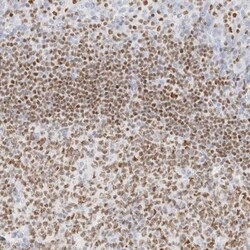 Aiolos/IKZF3 Antibody, Novus Biologicals:Antibodies:Primary Antibodies