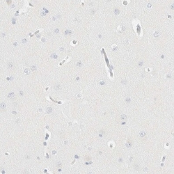 Aiolos/IKZF3 Antibody, Novus Biologicals:Antibodies:Primary Antibodies