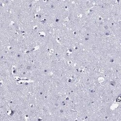 Aiolos/IKZF3 Rabbit anti-Human, Polyclonal, Novus Biologicals 100 &mu;g;