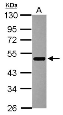 Aiolos/IKZF3 Antibody, Novus Biologicals 0.1mL; Unlabeled:Antibodies, Polyclonal