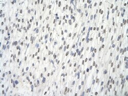 Alanyl tRNA synthetase Antibody, Novus Biologicals:Antibodies:Primary Antibodies