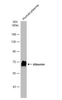 Albumin Antibody, Novus Biologicals 0.1mg; Unlabeled:Antikörper