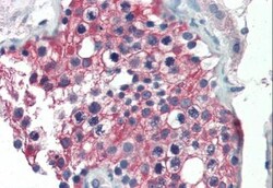 Aldehyde Dehydrogenase 1-A1/ALDH1A1 Antibody, Novus Biologicals 0.1mg;
