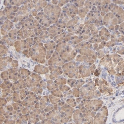 Aldehyde Dehydrogenase 1-A1/ALDH1A1 Antibody, Novus Biologicals:Antibodies:Primary