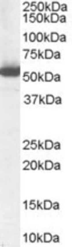 Aldehyde Dehydrogenase 1-A1/ALDH1A1 Antibody, Novus Biologicals 0.1mg;