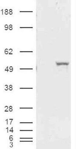 Aldehyde Dehydrogenase 1-A1/ALDH1A1 Antibody, Novus Biologicals 0.1mg;