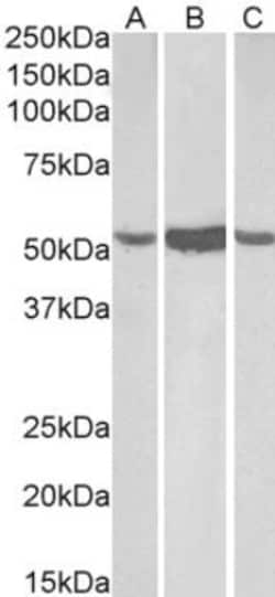 Aldehyde Dehydrogenase 1-A1/ALDH1A1 Antibody, Novus Biologicals 0.1 mg | Buy Online | Novus Biologicals | Fisher Scientific